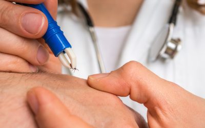 Zecken im Anmarsch: So schützen Sie sich vor FSME und Borreliose